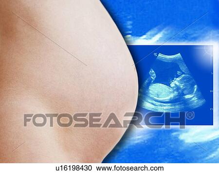 Stock Image - Baby scan. Fotosearch