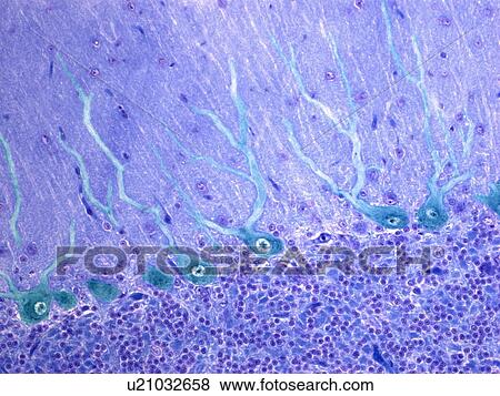 Nerve cells, light micrograph View Large Photo Image Stock Photo - Nerve cells, light micrograph. Fotosearch