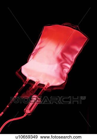 Stock Photo - Blood bag. Fotosearch