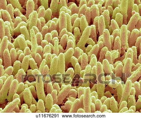 Dental plaque, SEM View Large Photo Image Stock Image - Dental plaque, SEM. Fotosearch