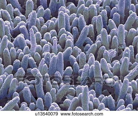 Dental plaque, SEM View Large Photo Image Stock Photo - Dental plaque, SEM. Fotosearch