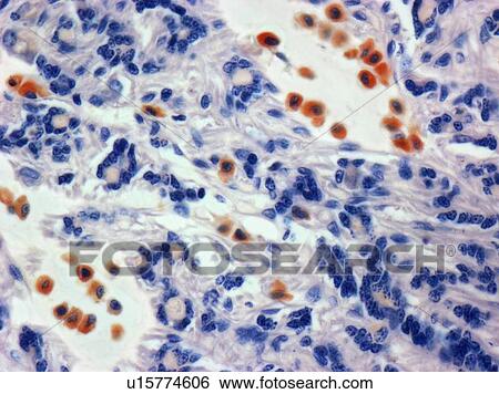 Mast cells, light micrograph View Large Photo Image Stock Photograph - Mast cells, light micrograph. Fotosearch