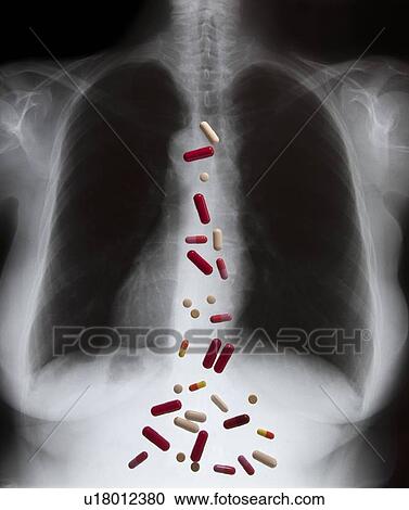 Stock Image - Overdose, conceptual image. Fotosearch