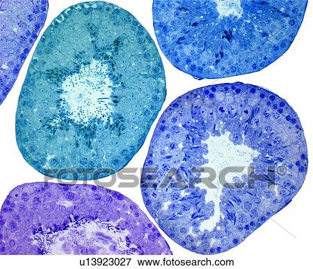 Seminiferous tubules, light micrograph View Large Photo Image Stock Photo - Seminiferous tubules, light micrograph. Fotosearch