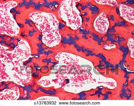 Stock Image - Spinal bone, light micrograph. Fotosearch