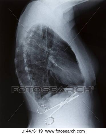 Surgical errors, conceptual image View Large Photo Image Stock Photo - Surgical errors, conceptual image. Fotosearch