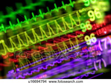 Picture - Vital signs monitor. Fotosearch