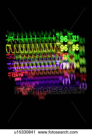 Vital signs monitor View Large Photo Image Stock Image - Vital signs monitor. Fotosearch