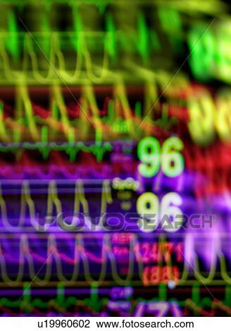 Vital signs monitor View Large Photo Image Stock Image - Vital signs monitor. Fotosearch