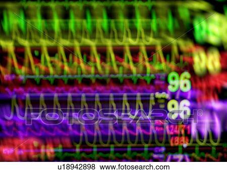 Vital signs monitor View Large Photo Image Stock Photo - Vital signs monitor. Fotosearch