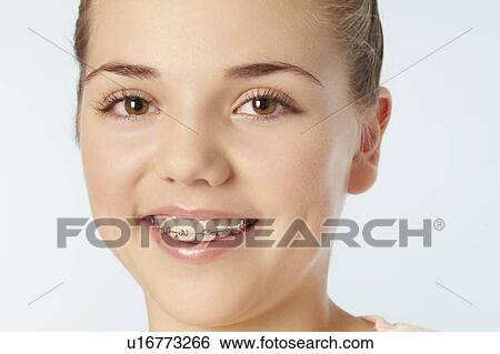 Close up of smiling girl in braces View Large Photo Image Stock Photograph - Close up of smiling girl in braces. Fotosearch