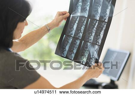 Doctor looking at x-ray image View Large Photo Image Stock Image - Doctor looking at x-ray image. Fotosearch