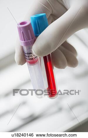 Close up of hand in surgical glove holding laboratory vials, studio shot View Large Photo Image Stock Photograph - Close up of hand in surgical glove holding laboratory vials, studio shot. Fotosearch