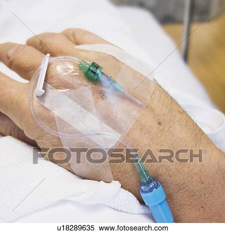 Stock Photography - Close up of hand of elderly patient with IV drip attached. Fotosearch