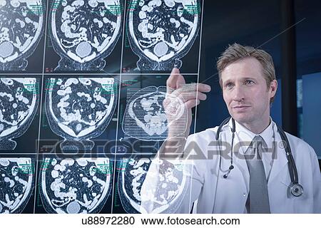 Stock Image - Doctor looking at computed tomography (CT) scans on screen. Fotosearch