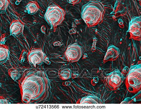 Stock Photograph - 3D SEM image of ladybird larva, 8 degree tilt. Fotosearch