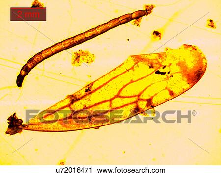 Stock Image - Mosquito larva under a microscope. Fotosearch