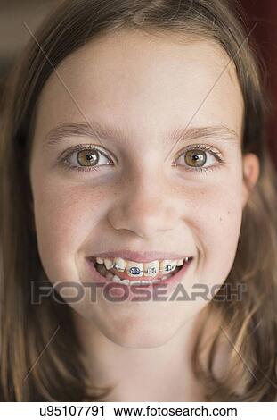 Girl (8-9) showing braces View Large Photo Image Stock Image - Girl (8-9) showing braces. Fotosearch