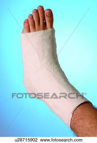 Stock Image - ankle, break, bandages, aid. Fotosearch
