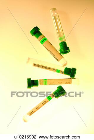 Stock Image - beaker, chemistry, chemical, analysis. Fotosearch