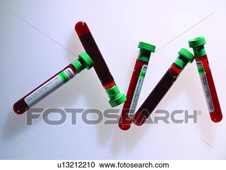 beaker, chemistry, chemical, analysis View Large Photo Image Stock Image - beaker, chemistry, chemical, analysis. Fotosearch