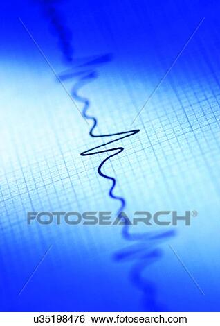 Stock Photograph - biology, lab, ecg, graph. Fotosearch