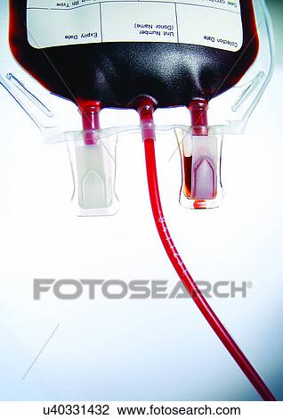 Stock Image - blood bag, bottle, dosage, dose. Fotosearch