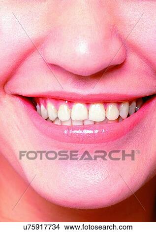 Picture - Braces, Chin, Close-Up, Facial Expression. Fotosearch