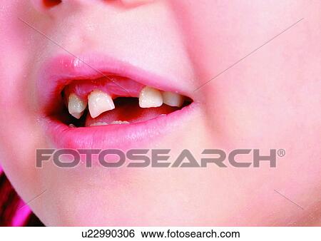 Stock Photograph - Chin, Close-Up, Facial Expression. Fotosearch
