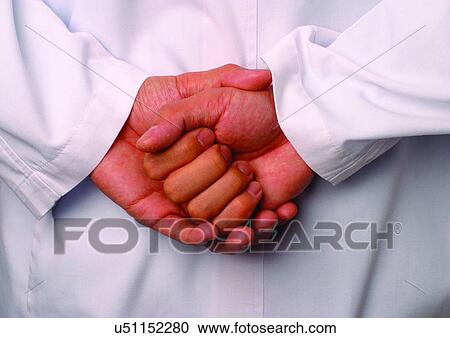 Stock Image - clinching, aid. Fotosearch