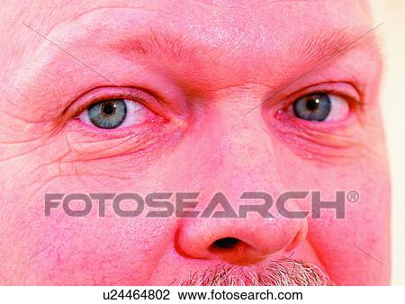 Close-Up, Cornea, Detail, Eye Lashes, Eyeball View Large Photo Image Stock Image - Close-Up, Cornea, Detail, Eye Lashes, Eyeball. Fotosearch