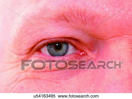 Close-Up, Cornea, Detail, Eye Lashes, Eyeball View Large Photo Image Stock Photography - Close-Up, Cornea, Detail, Eye Lashes, Eyeball. Fotosearch