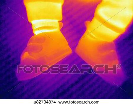Picture - Thermal image of shoes of three month old baby. Fotosearch