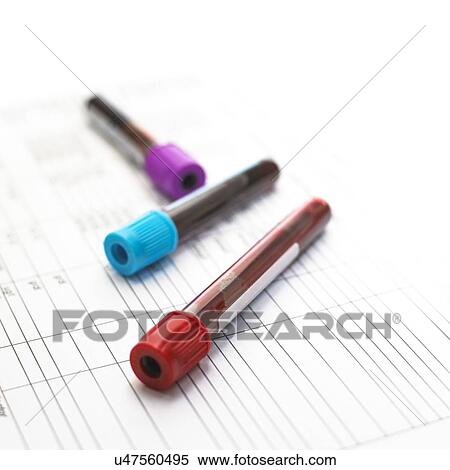 Blood samples View Large Photo Image Stock Photography - Blood samples. Fotosearch