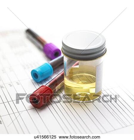 Stock Photography - Urine and blood samples. Fotosearch