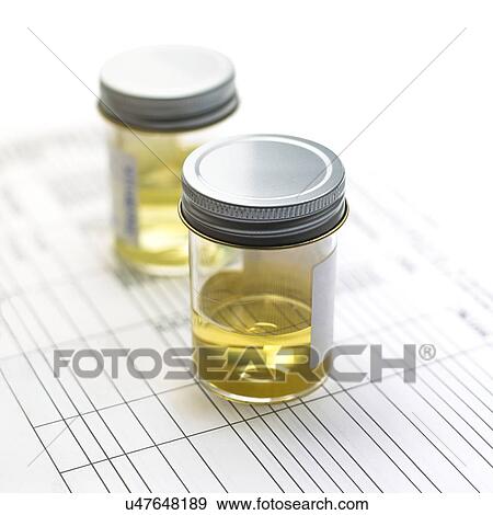 Urine samples View Large Photo Image Stock Photo - Urine samples. Fotosearch