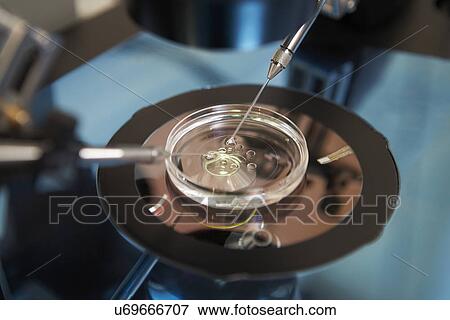 Laboratory Fertilization Of Eggs In IVF Treatment View Large Photo Image Stock Photo - Laboratory Fertilization Of Eggs In IVF Treatment. Fotosearch