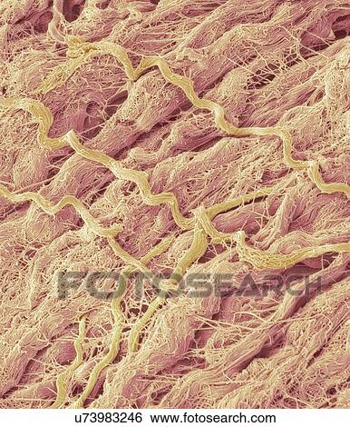 Dense connective tissue, SEM View Large Photo Image Stock Photograph - Dense connective tissue, SEM. Fotosearch