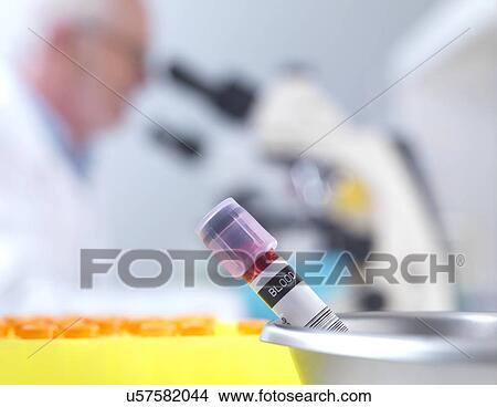 Picture - Haematology lab. Fotosearch