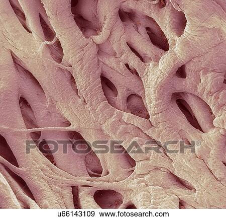 Heart strings, SEM View Large Photo Image Stock Photo - Heart strings, SEM. Fotosearch