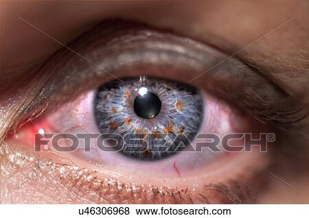 Stock Photo - Human Eye. Fotosearch