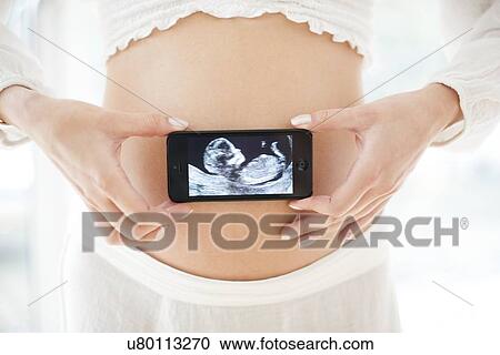 Stock Image - Pregnant woman and baby scan. Fotosearch