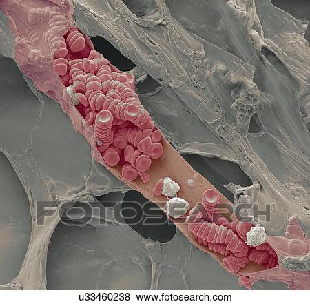 Stock Photo - Ruptured venule, SEM. Fotosearch