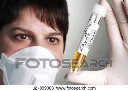 Stock Image - Urine samples. Fotosearch