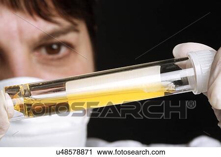Stock Image - Urine samples. Fotosearch
