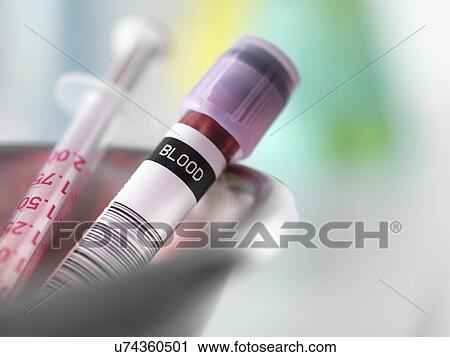 Blood sample taken for analysis with needle View Large Photo Image Stock Image - Blood sample taken for analysis with needle. Fotosearch