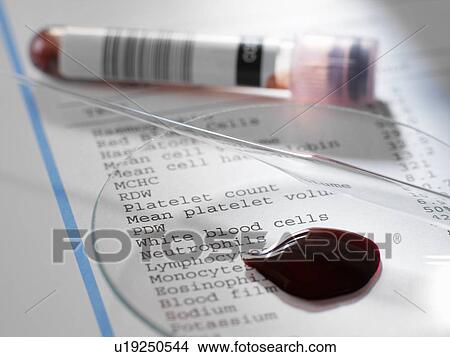 Picture - Blood sample with results of clinical analysis of the blood component. Fotosearch
