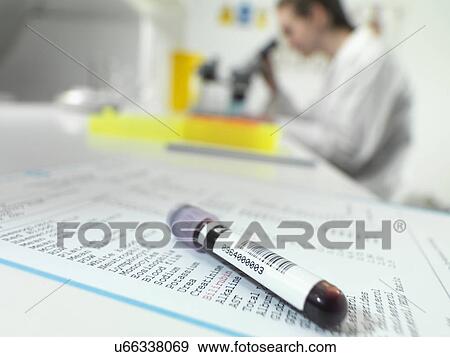 Stock Photo - Blood tube sitting on blood results with technician at microscope in lab. Fotosearch