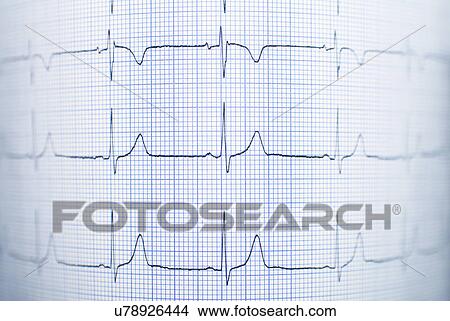 Healthy electrocardiogram View Large Photo Image Picture - Healthy electrocardiogram. Fotosearch