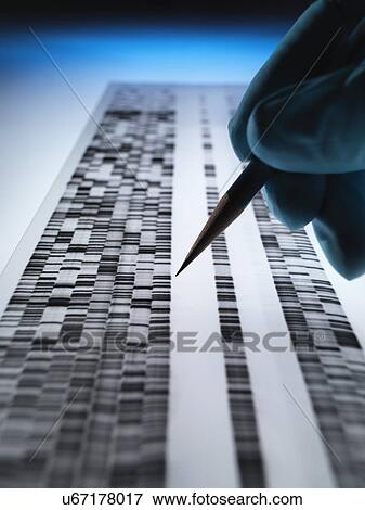 Stock Photo - Scientist viewing DNA gel used in genetics, forensic, pharma research, biotechnology and biomedical science. Fotosearch